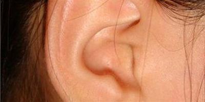 左耳耳廓有痣是代表什麼意思？ 小編為你揭開其中的奧秘