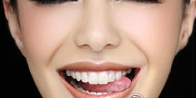 識人術：從牙齒看你的福氣程度
