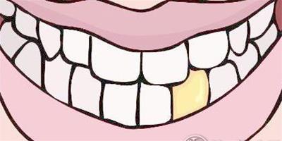 牙齒算命 有鬼牙不吉利嗎