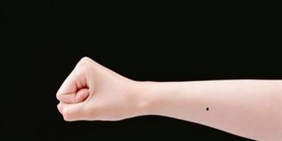 手臂上長痣代表什麼 手臂痣相圖解