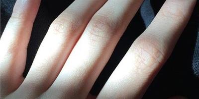 日本教你從手的大小及指頭形狀來分析個性